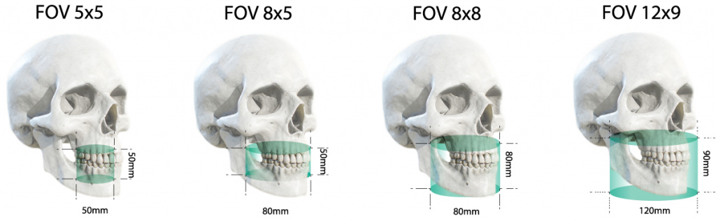 PaX-i3D имеет размеры области сканирования в диапазоне от 5х5 до 12х9